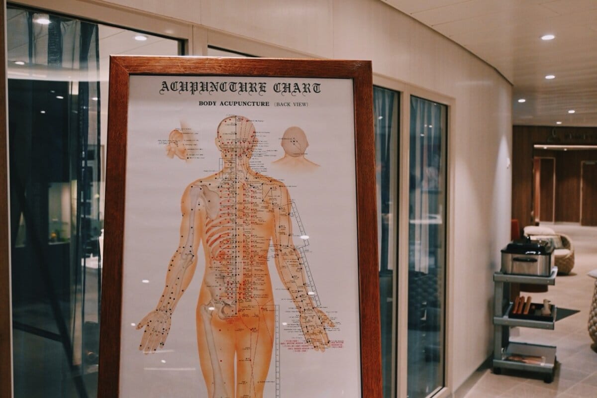 Acupuncture services on a Royal Caribbean ship