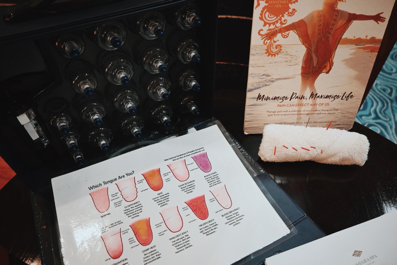 NCL Spa Menu Acupuncture 